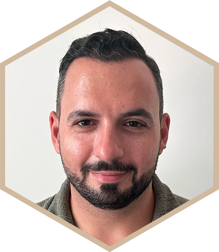 hajbeultetes-a-janos-utana-2 Hair transplantation