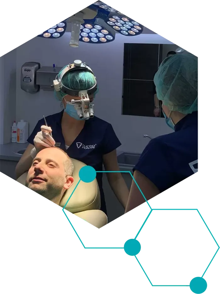 hajbeultetes-ferfiaknak-01 Die Haartransplantation